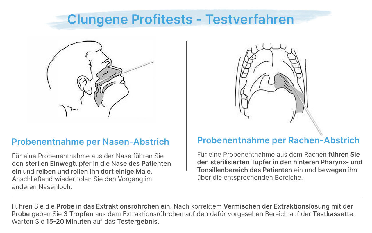 Clungene COVID-19 Antigen Rapid Tests Anwendung